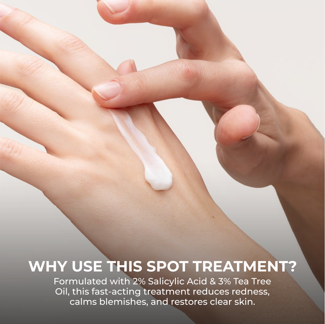 Acne Spot Treatment