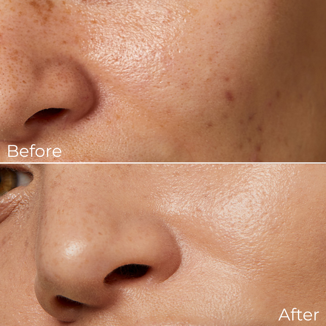 Niacinamide Gel Cream – Brightening & Hydrating with 5% Niacinamide & Vitamin B3